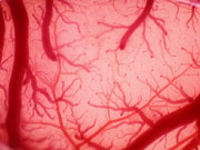 [写真]脳の血管は表面から深部に直角に入り込む